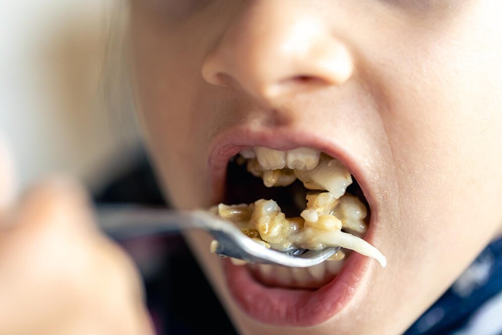 Tooth Cavities